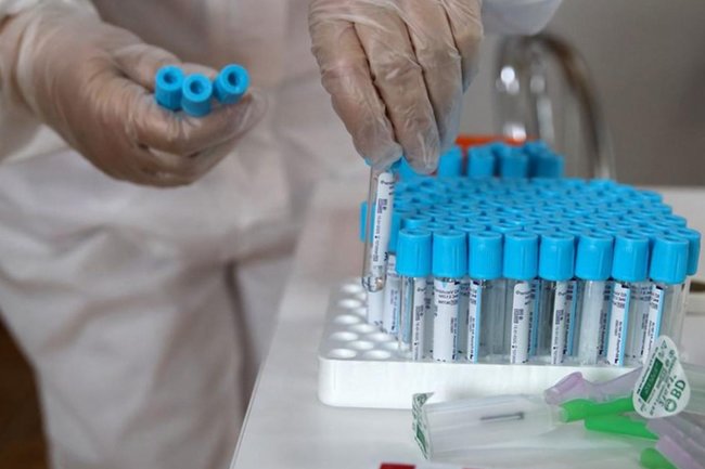 Коронавирус, медицина