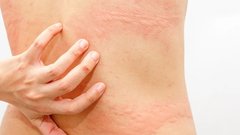 Обнаружен эффективный метод замедления прогрессирования деменции и снижения смертности почти на треть