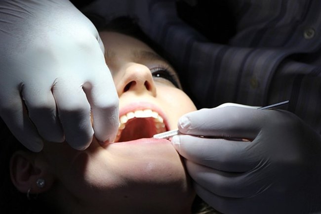 стоматолог зубы