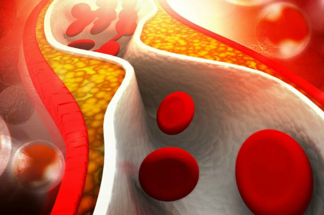 Холестерин