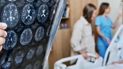 Японские ученые нашли метод предотвращения формирования белковых фибрилл при болезни Альцгеймера