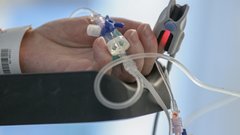 Выяснилось состояние пациента с диагнозом «оспа обезьян» в Подмосковье