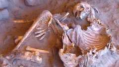 Ученые развеяли миф, будто кальций укрепляет кости