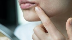 Как оперативно избавиться от герпеса на губах?