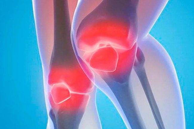 komprimira liječenje osteoartritisa klikne na zglob kuka i donji dio leđa