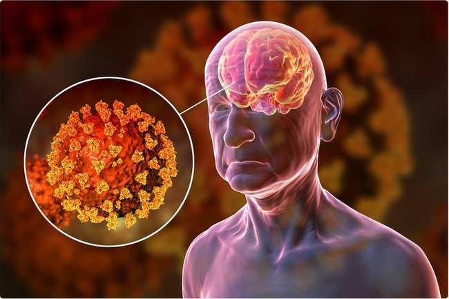 После перенесенного коронавируса мозг человека стареет на 20 лет
