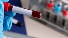 Жесткие диеты и замедление метаболизма: миф или реальность