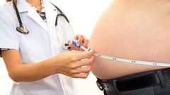 Минздрав: До трети россиян могут страдать ожирением