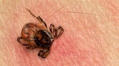 Число укусов клещами россиян увеличилось вдвое