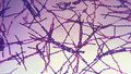 Микрофотография бацилл сибирской язвы.