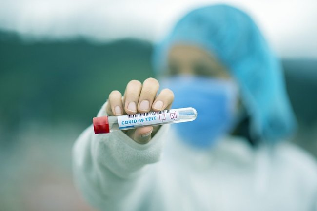 За последние сутки в Оренбуржье подтверждено еще 183 случая заражения коронавирусом