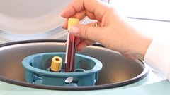 Специалист рассказал о важном анализе крови для мужчин старше 50 лет