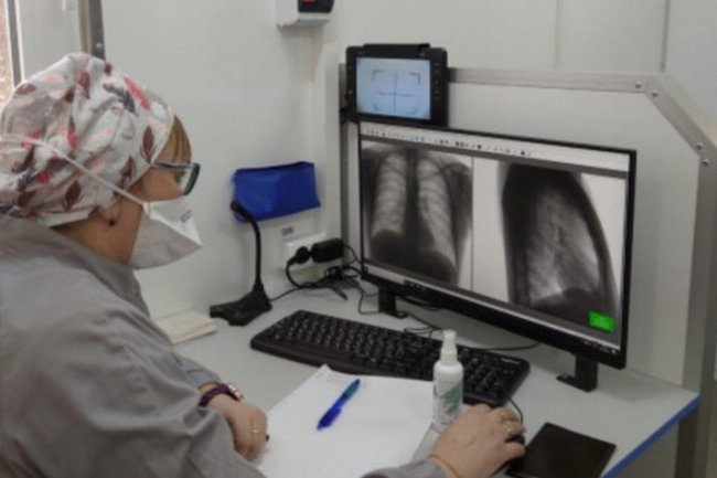 Борьба с туберкулезом, Новосибирская область