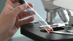 Исследование в Nature Microbiology: вирус рыб способен поражать человеческие глаза