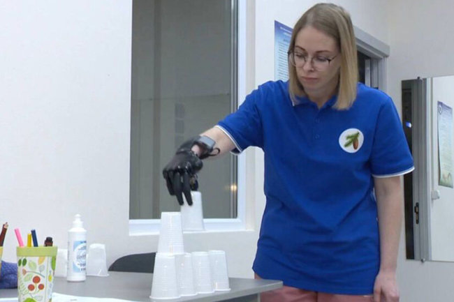 На Ямале изготовили бионический протез кисти для местной жительницы