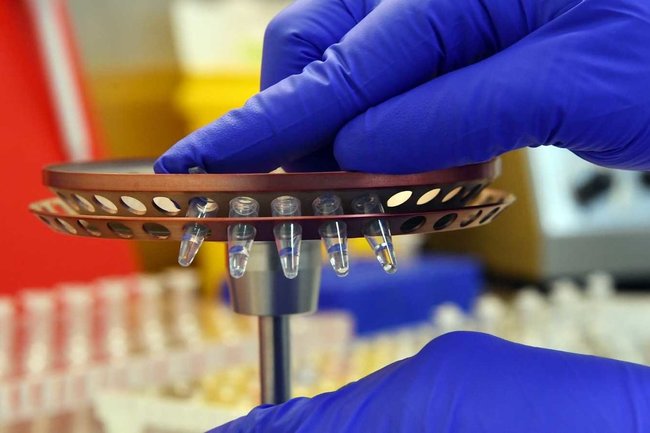 Еще 6 лабораторий для тестов на коронавирус открылись в Ленобласти