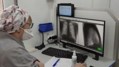 Специалист по туберкулезу рассказала, что способствовало уменьшению заболеваемости