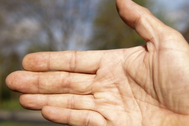 рука / пальцы