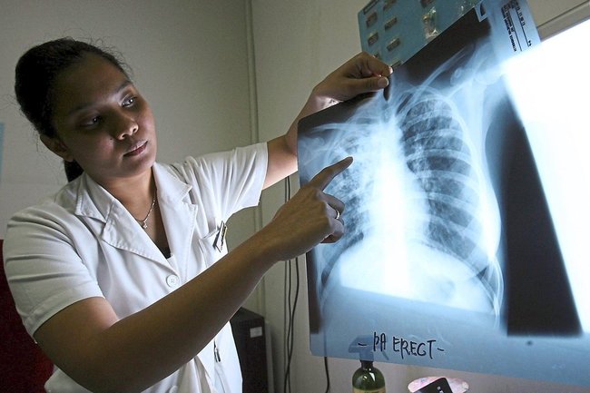 ранние симптомы рака лёгких