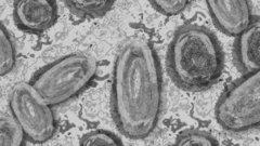 В Подмосковье зарегистрированы еще два случая оспы обезьян