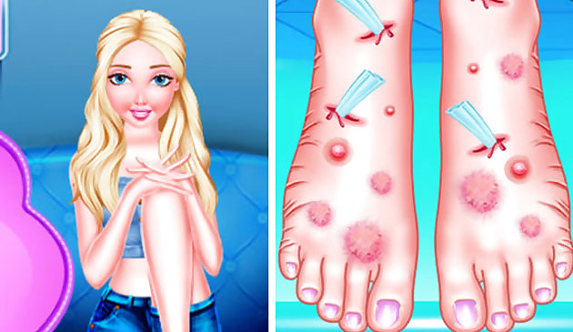 Лечение ног Эммы