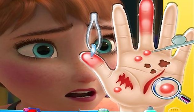 안나 냉동 손 닥터 : 소녀 온린을위한 재미있는 게임