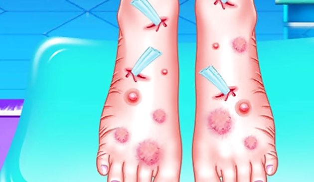 Эмма лечение ноги